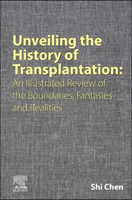 Unveiling the History of Transplantation: An Illustrated Review of the Boundaries, Fantasies and Realities
