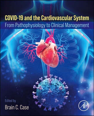 Covid-19 and the Cardiovascular System: From Pathophysiology to Clinical Management