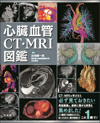 ηCT.MRI