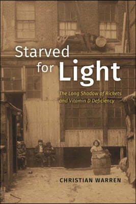 Starved for Light: The Long Shadow of Rickets and Vitamin D Deficiency