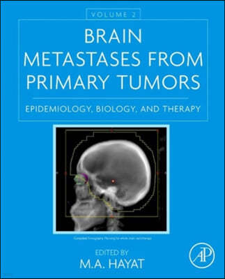 Brain Metastases from Primary Tumors, Volume 2: Epidemiology, Biology, and Therapy