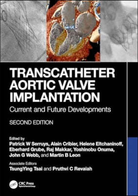 Transcatheter Aortic Valve Implantation