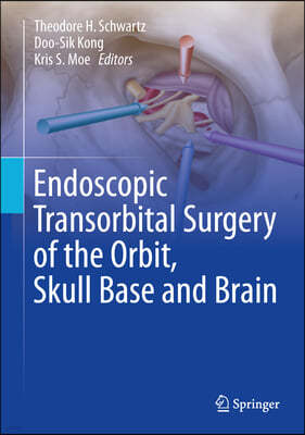 Endoscopic Transorbital Surgery of the Orbit, Skull Base and Brain