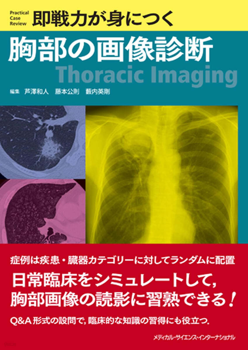 卽戰力が身につく胸部の畵像診斷