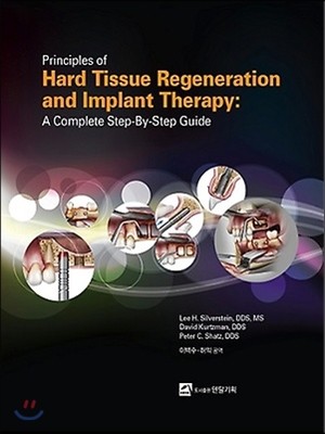 Principles of Hard Tissue Regeneration and Implant Therapy
