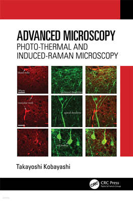 Advanced Microscopy: Photo-Thermal and Induced-Raman Microscopy