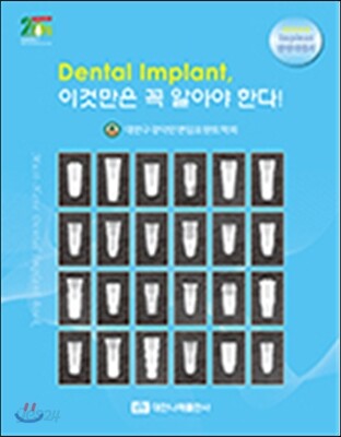 Dental Implant, 이것만은 꼭 알아야 한다!