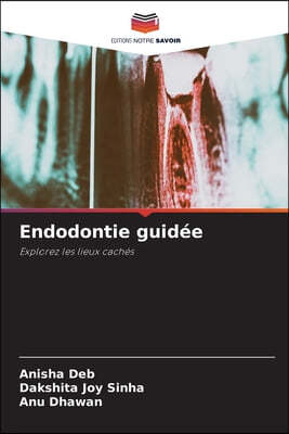 Endodontie guidée