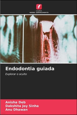 Endodontia guiada