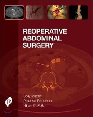 Reoperative Abdominal Surgery