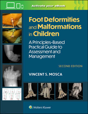 Foot Deformities and Malformations in Children: A Principles-Based, Practical Guide to Assessment and Management: Print + eBook with Multimedia