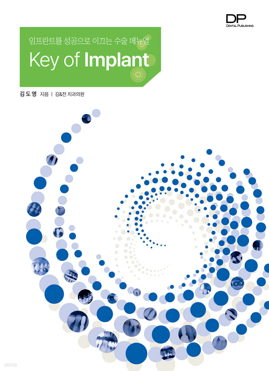 Key of Implant 1