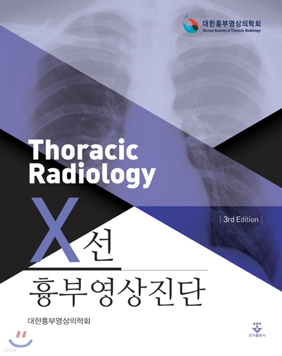 흉부영상진단 X선