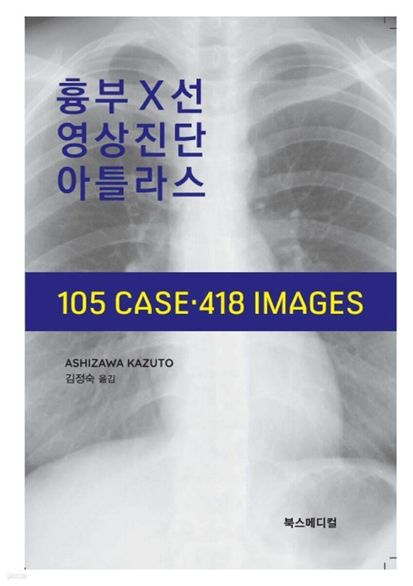 흉부X선 영상진단 아틀라스