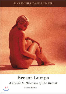 Breast Lumps: A Guide to Diseases of the Breast