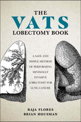 The Vats Lobectomy Book: A Safe and Simple Method of Performing Minimally Invasive Lobectomy for Lung Cancer