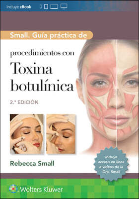 Small. Guia practica de procedimientos con toxina botulinica