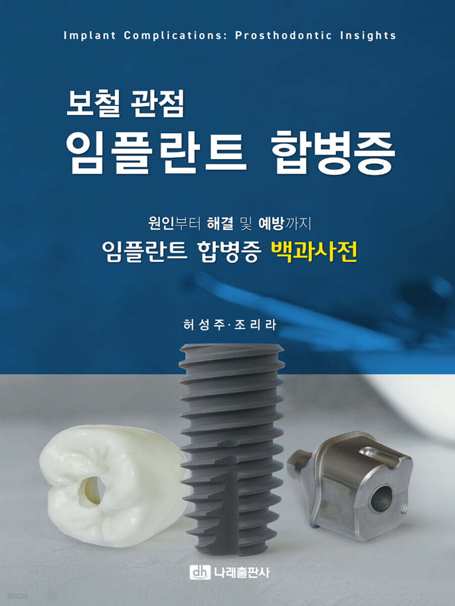 보철 관점 임플란트 합병증