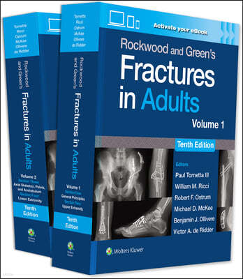 Rockwood and Green's Fractures in Adults: Print + eBook with Multimedia