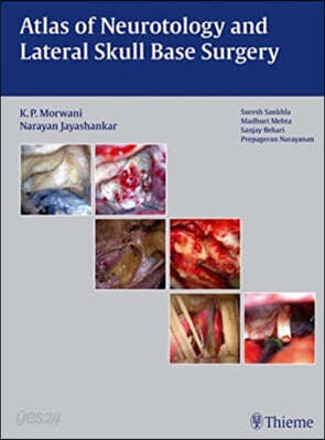 Atlas of Neurotology and Lateral Skull Base Surgery