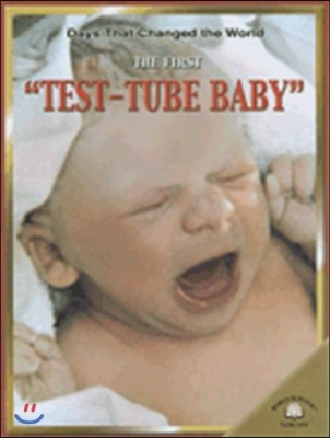 The First "TEST-TUBE BABY"