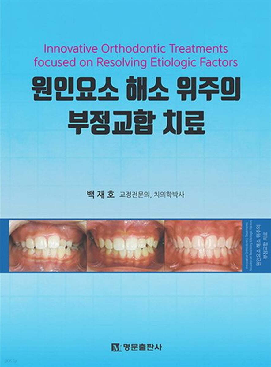 원인요소 해소 위주의 부정교합 치료