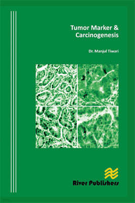 Tumor Marker and Carcinogenesis