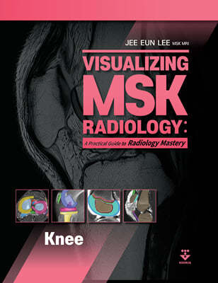 Visualizing MSK Radiology : A Practical Guide to Radiology Mastery