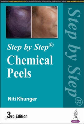 Step by Step: Chemical Peels