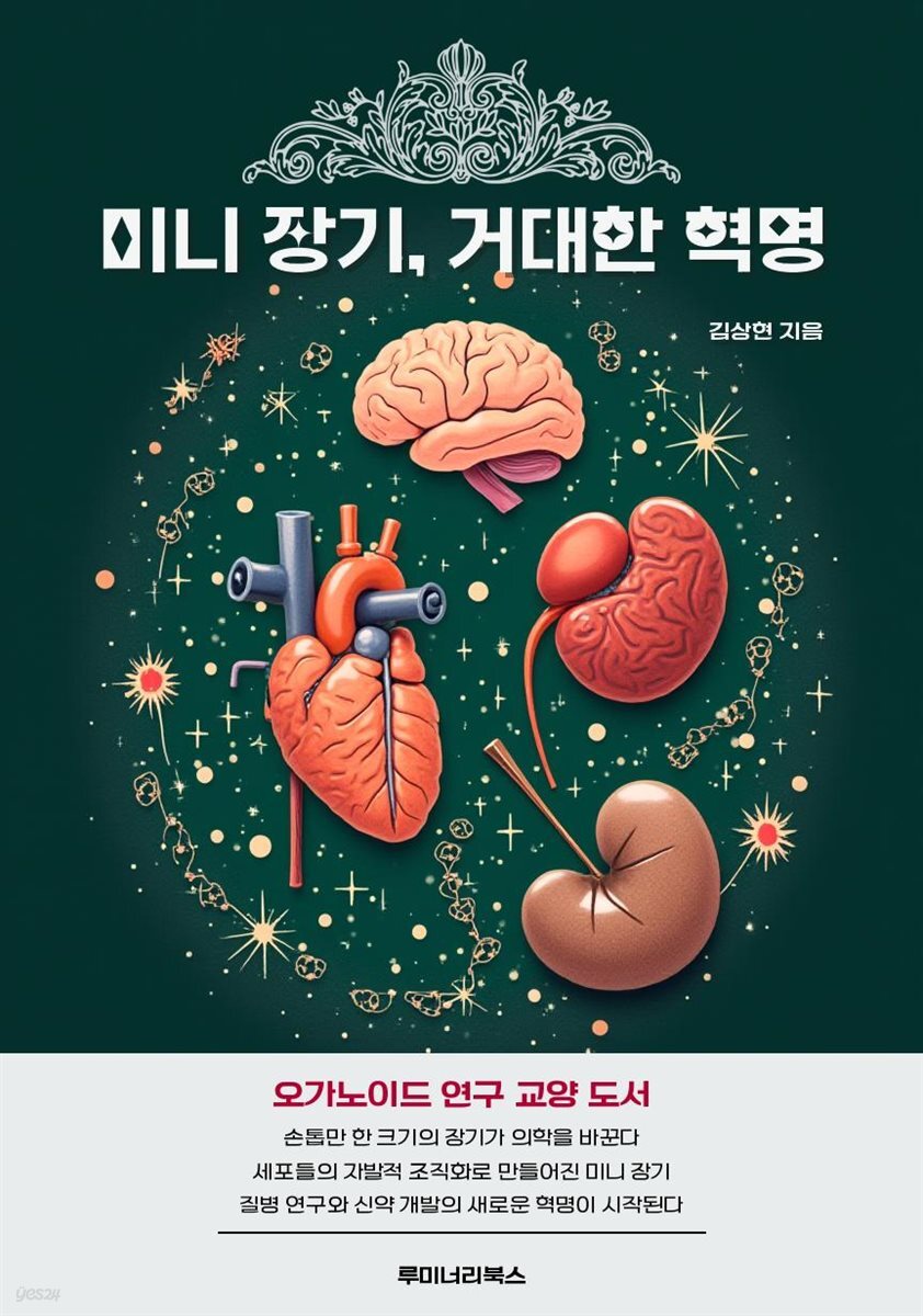 미니 장기, 거대한 혁명