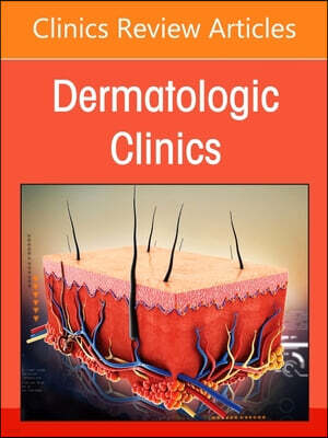 Elsevier Hidradenitis Suppurativa, an Issue of Dermatologic Clinics: Volume 43-2