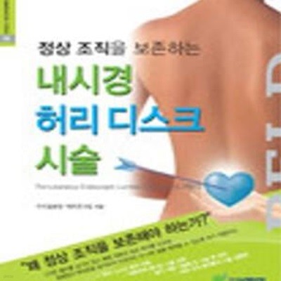 내시경 허리 디스크 시술 (정상 조직을 보존하는)