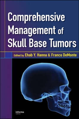 Comprehensive Management of Skull Base Tumors