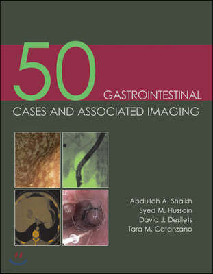 50 Gastrointestinal Cases & Associated Imaging