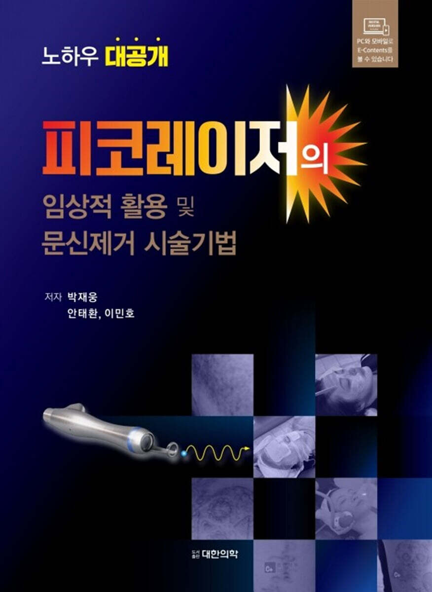 피코레이저의 임상적 활용 및 문신제거 시술기법