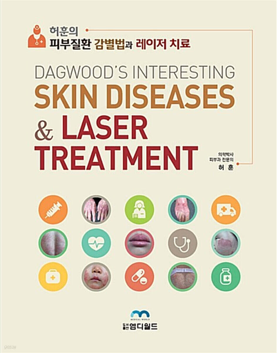 허훈의 피부질환 감별법과 레이저 치료