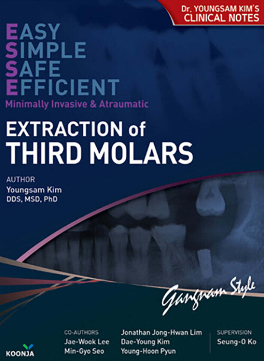 Extraction of Third Molars