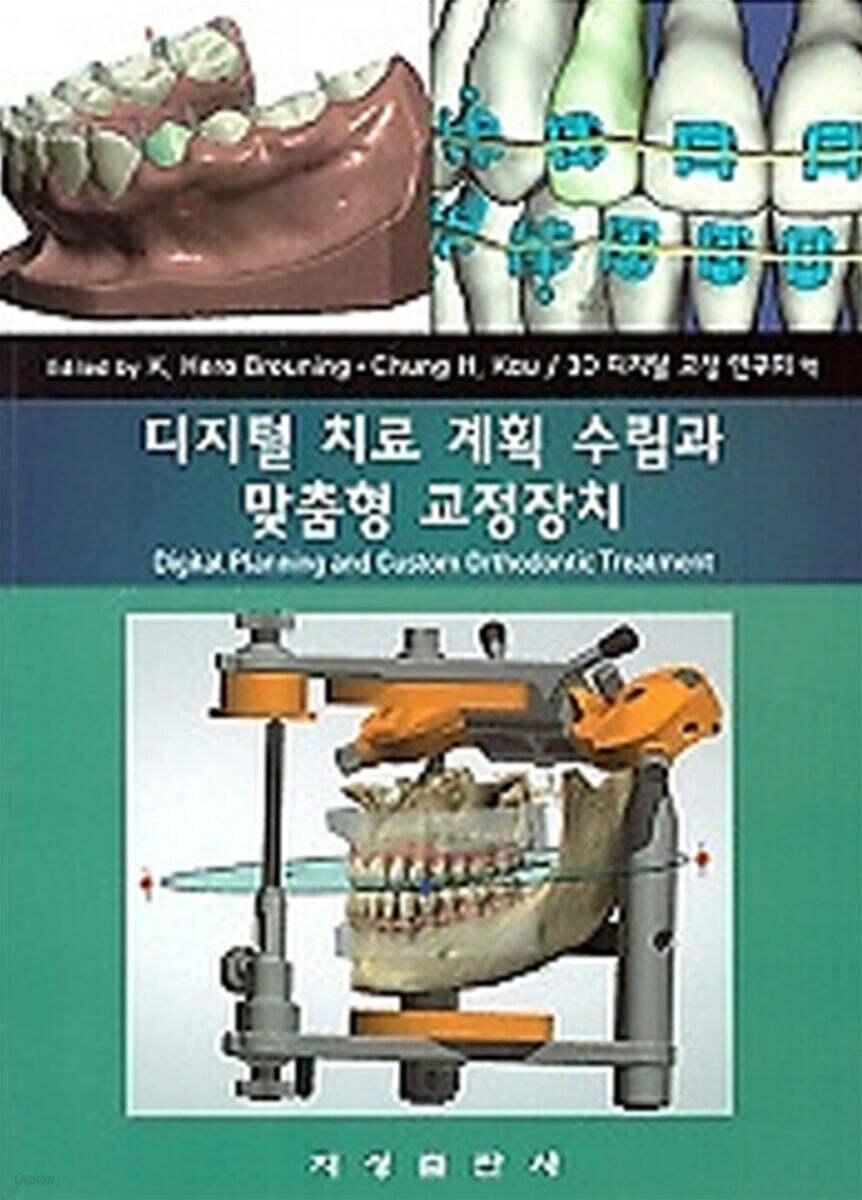 디지털 치료 계획 수립과 맞춤형 교정장치