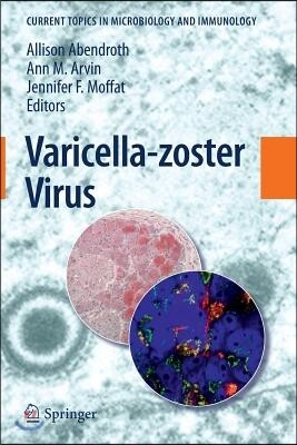 Varicella-Zoster Virus