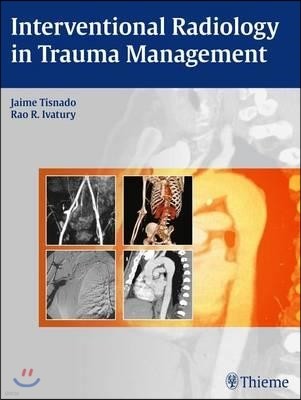 Interventional Radiology in Trauma