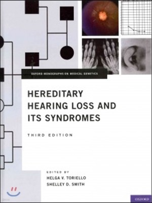 Hereditary Hearing Loss and Its Syndromes