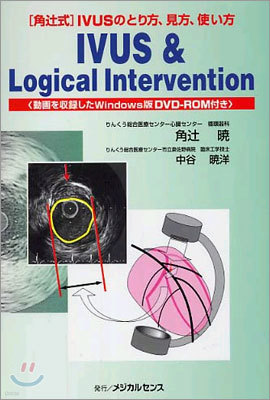 IVUS & Logical intervention