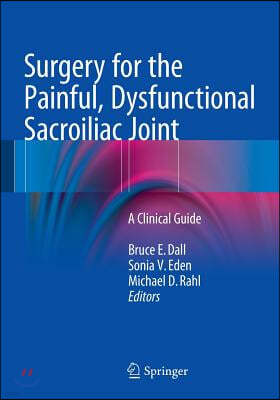 Surgery for the Painful, Dysfunctional Sacroiliac Joint: A Clinical Guide