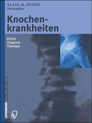 Knochenkrankheiten: Klinik Diagnose Therapie