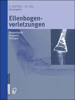 Ellenbogenverletzungen: Biomechanik  Diagnose  Therapie