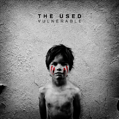 Used — Vulnerable (US Indie Exclusive) 앨범 커버