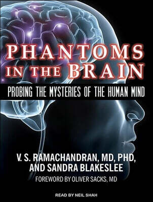 Phantoms in the Brain