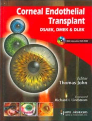 Corneal Endothelial Transplant