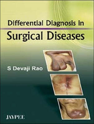 Differential Diagnosis in Surgical Diseases