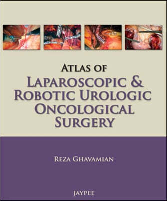 Atlas of Laparoscopic and Robotic Urologic Oncological Surgery